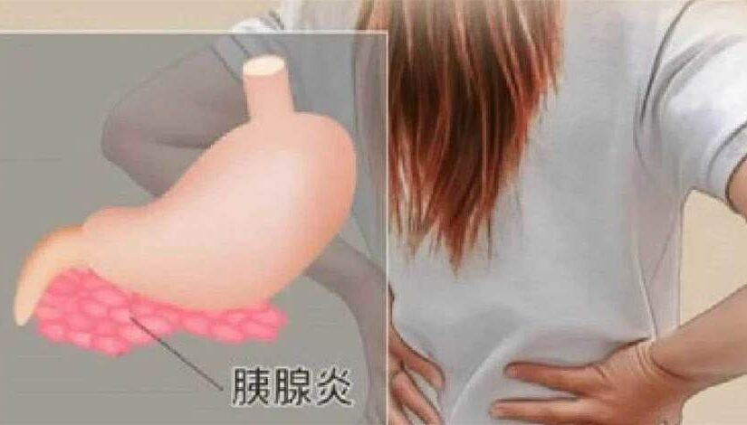女子每天「大便兩三次」確診胰腺癌！醫生提醒：出現四種異常恐是身體「警報」…
